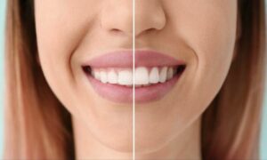 Gum Aesthetics (Розовая Эстетика)