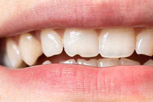 Что такое стоматологические аномалии?