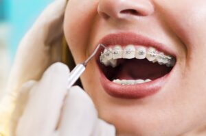 Ortodontik Tedavisi