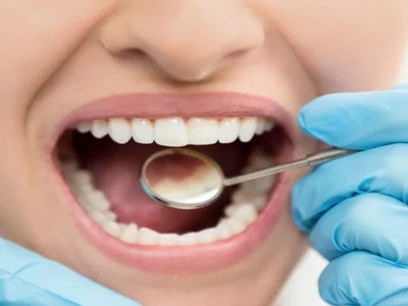 Periodontoloji Tedavisi