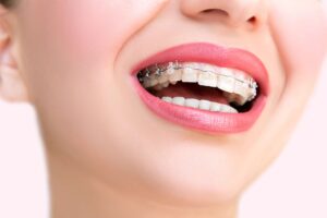 Ortodontik Tedavi Sorası