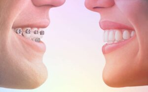 Виды стоматологического лечения