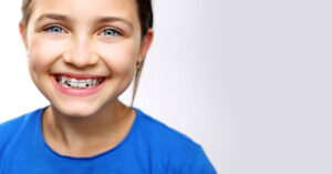 Лечение кривых зубов