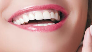 Виды стоматологической эстетики