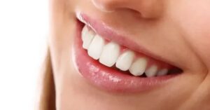 Estetik Gülüş Tasarımı