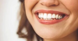 Estetik Gülüş Tasarımı