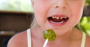 Çocuklarda Diş Çürüğü