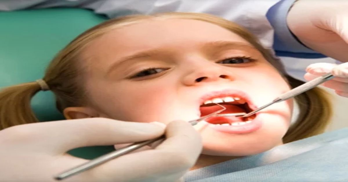 Çocuklarda Diş Çürümesi