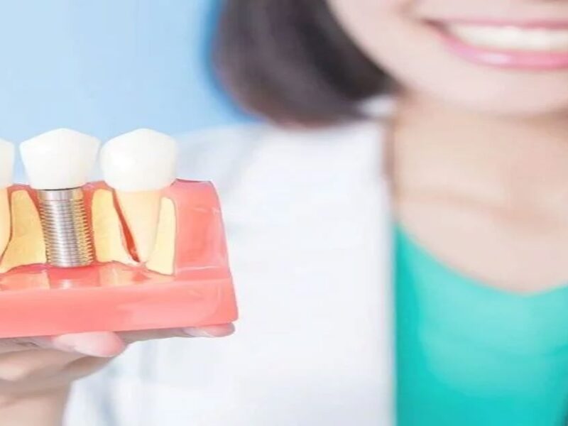 Diş İmplantı Nedir?