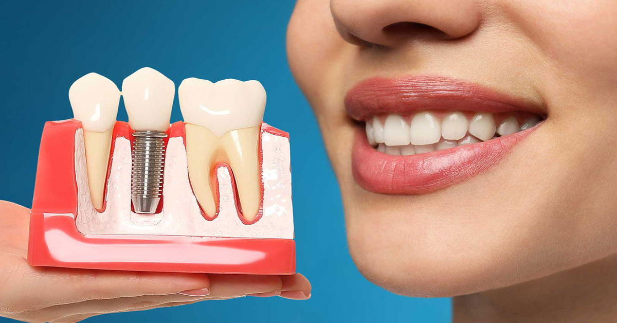 Zirkonyum İmplant Nasıl Yapılır?